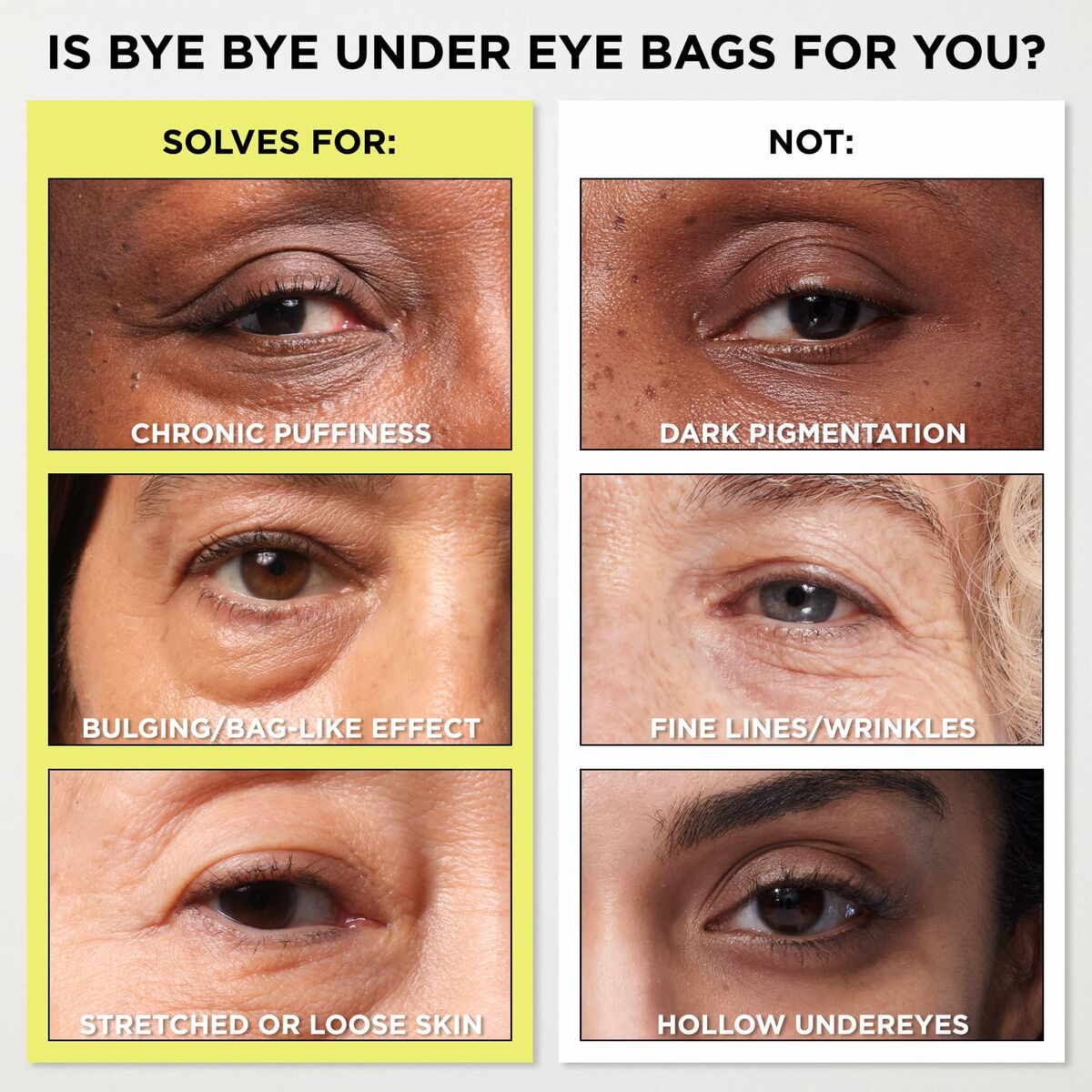 Comparison of eye conditions: solves chronic puffiness, bulging; does not target dark pigmentation, fine lines.
