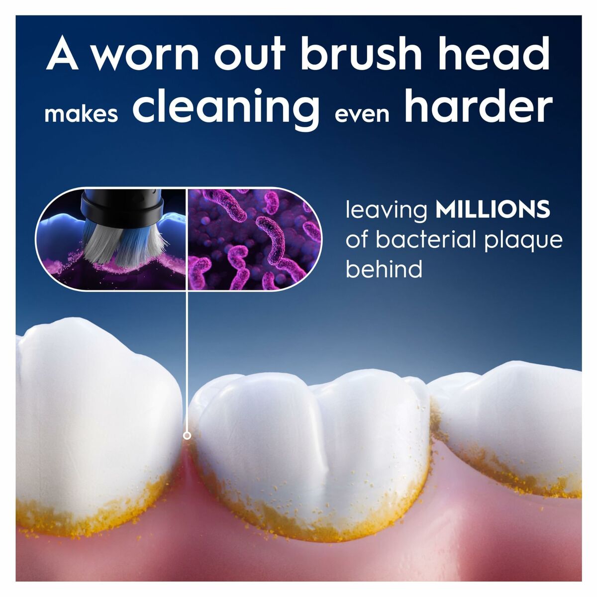 Image showing worn brush head making cleaning harder and leaving bacterial plaque behind.